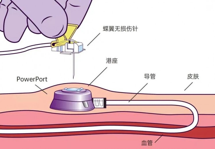 呵护生命通道宿迁市钟吾医院静疗护理门诊开诊啦！